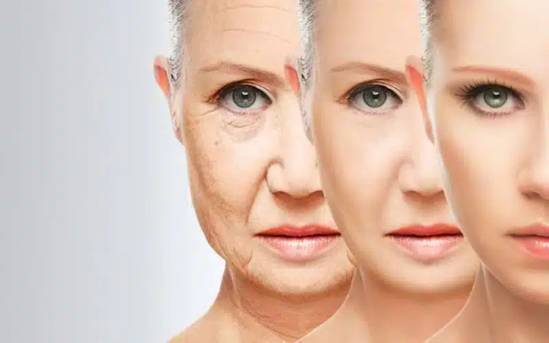 Close-up of a woman's face showing signs of aging compared across three stages