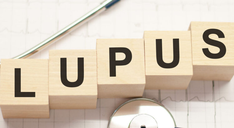 photo of blocks that spell ot the word lupus