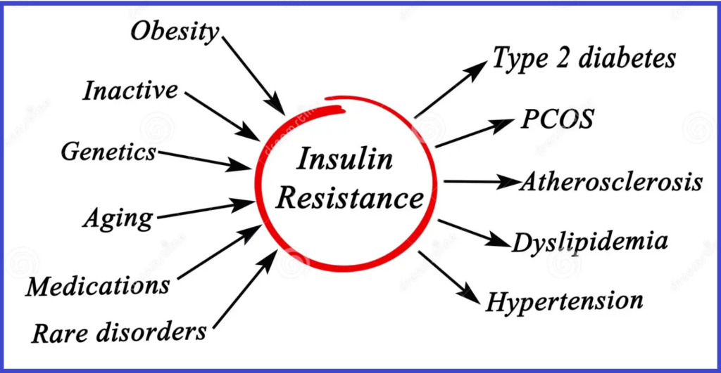 Diagram showing insulin resistance connected to related factors including obesity, type 2 diabetes, PCOS, and heart disease