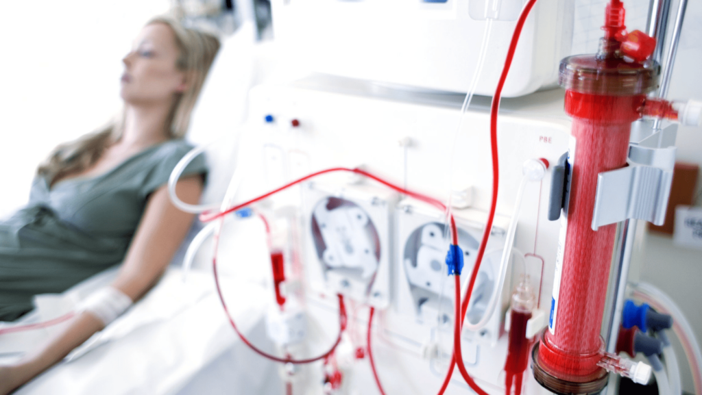 Patient connected to blood-filtering equipment during treatment